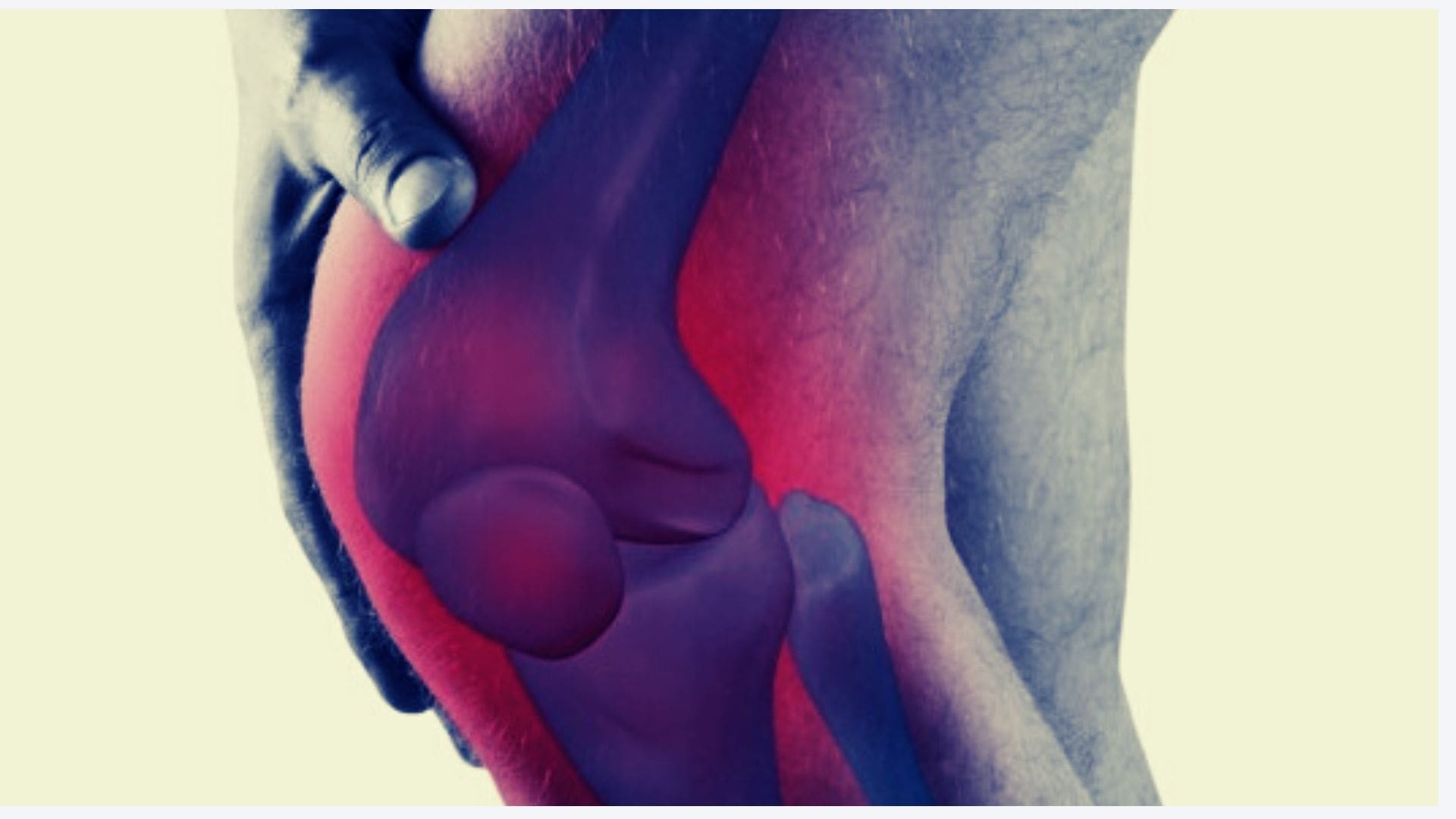 آرتروز آرتروز
